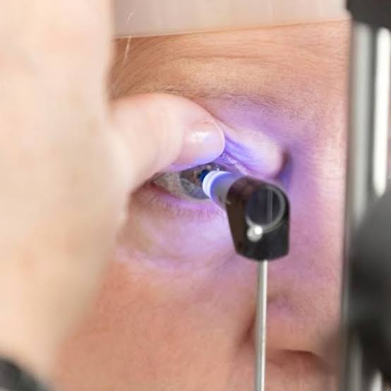 Saiba qual é a rotina ideal de consultas para cuidar da visão